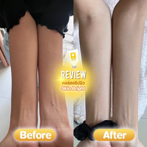 ดริปวิตามินผิว | IV-Drip | Swan Clinic (กังสดาล) - Image 6