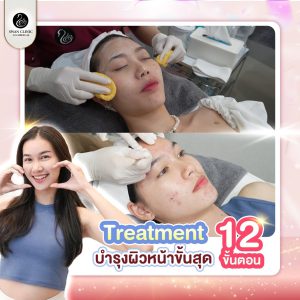 ทรีทเมนต์ | Healing Ultimate | SWAN CLINIC (กังสดาล)