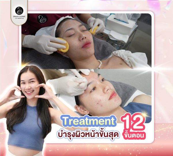 ทรีทเมนต์ | Healing Ultimate | SWAN CLINIC (กังสดาล)