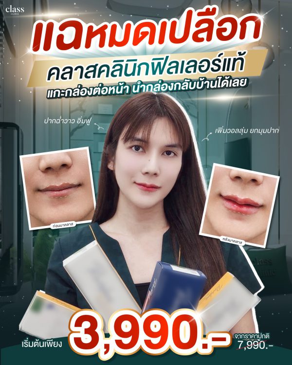 ฟิลเลอร์ | Restylane | Class Clinic (กังสดาล/หอกาญ) - Image 2