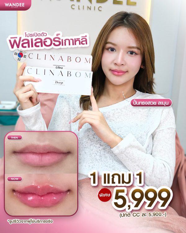 ฟิลเลอร์ | CLINABOM  | Wandee Clinic (กังสดาล) - Image 3