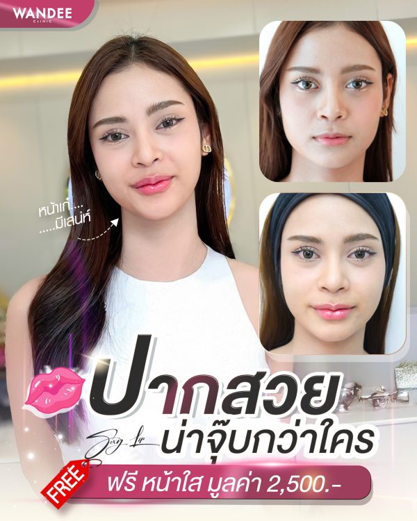 ฟิลเลอร์ | CLINABOM  | Wandee Clinic (กังสดาล) - Image 2