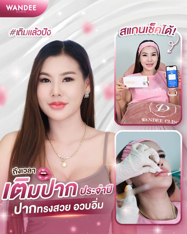 ฟิลเลอร์ | e.p.t.q | Wandee Clinic (กังสดาล) - Image 3