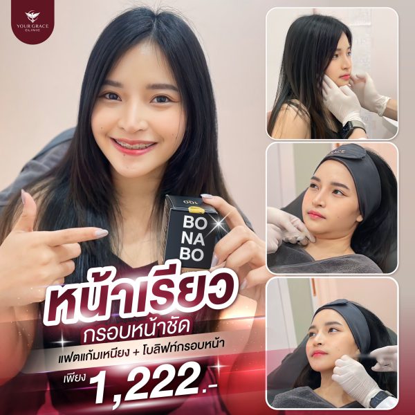 โบทอกซ์ | NABOTA | Your Grace Clinic (กังสดาล) - Image 2