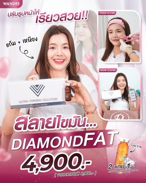 ฉีดสลายไขมัน | Diamond Fat |Wandee Clinic (กังสดาล) - Image 2