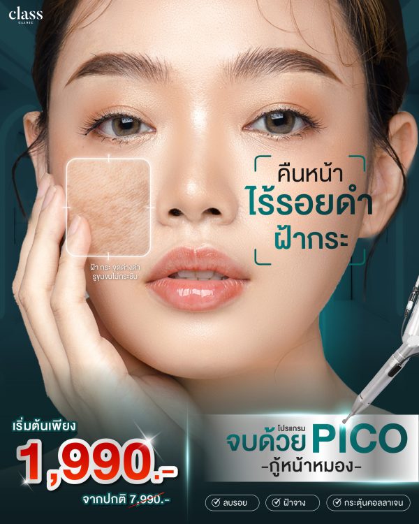 เลเซอร์ | รอยดำ รอยแดง ฟ้า กระ | Class Clinic (กังสดาล/หอกาญ) - Image 2