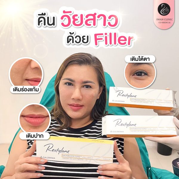 ฟิลเลอร์ | Restylane | SWAN CLINIC (กังสดาล) - Image 2