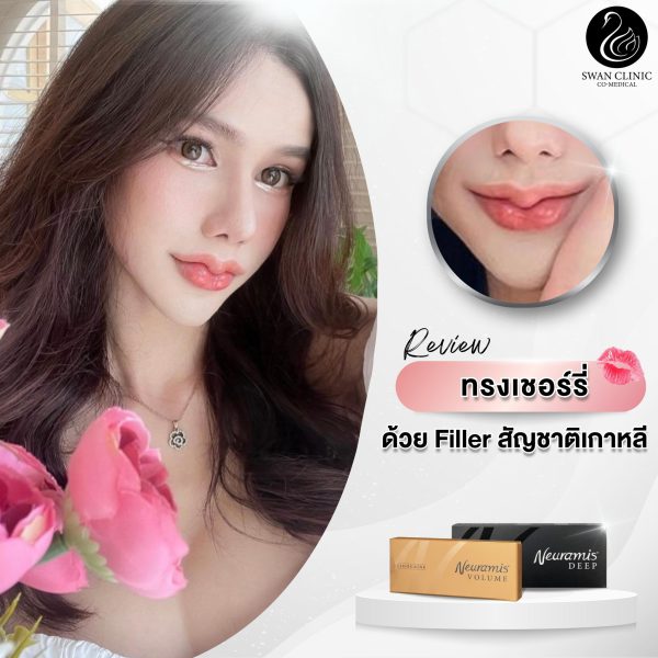 ฟิลเลอร์ | Neuramis | SWAN CLINIC (กังสดาล) - Image 2