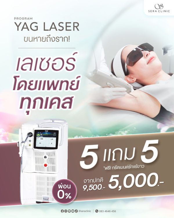 เลเซอร์ | กำจัดขน | Sera Clinic (กังสดาล) - Image 2