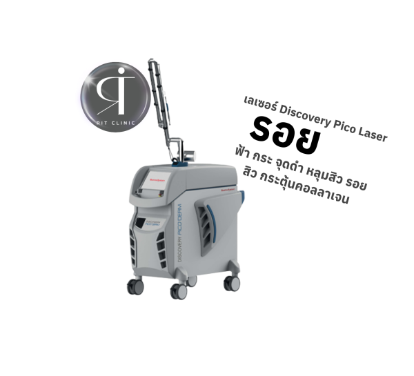 เลเซอร์ รอยสิว ฝ้า กระตื้น ริมฝีปากหมองคล้ำ หลุมสิว | Discovery Pico Laser | RIT CLINIC (กังสดาล)