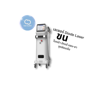 เลเซอร์กำจัดขน | Diode Laser | C&C Clinic (กังสดาล)