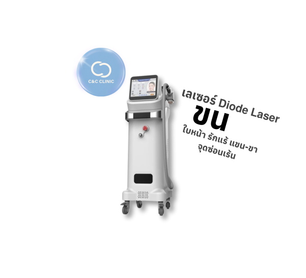 เลเซอร์กำจัดขน | Diode Laser | C&C Clinic (กังสดาล)